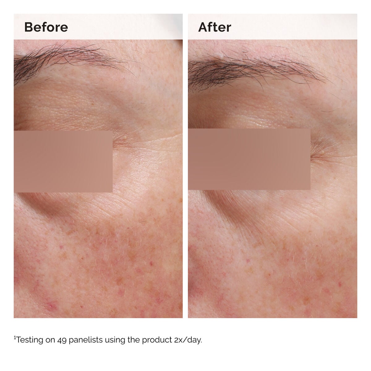 niacinamide-5-face-and-body-emulsion-y3 2024-08-23-ORD-Nia-5pct-Face-Body-B-A-Elasticity-Global-02-1x1.jpg