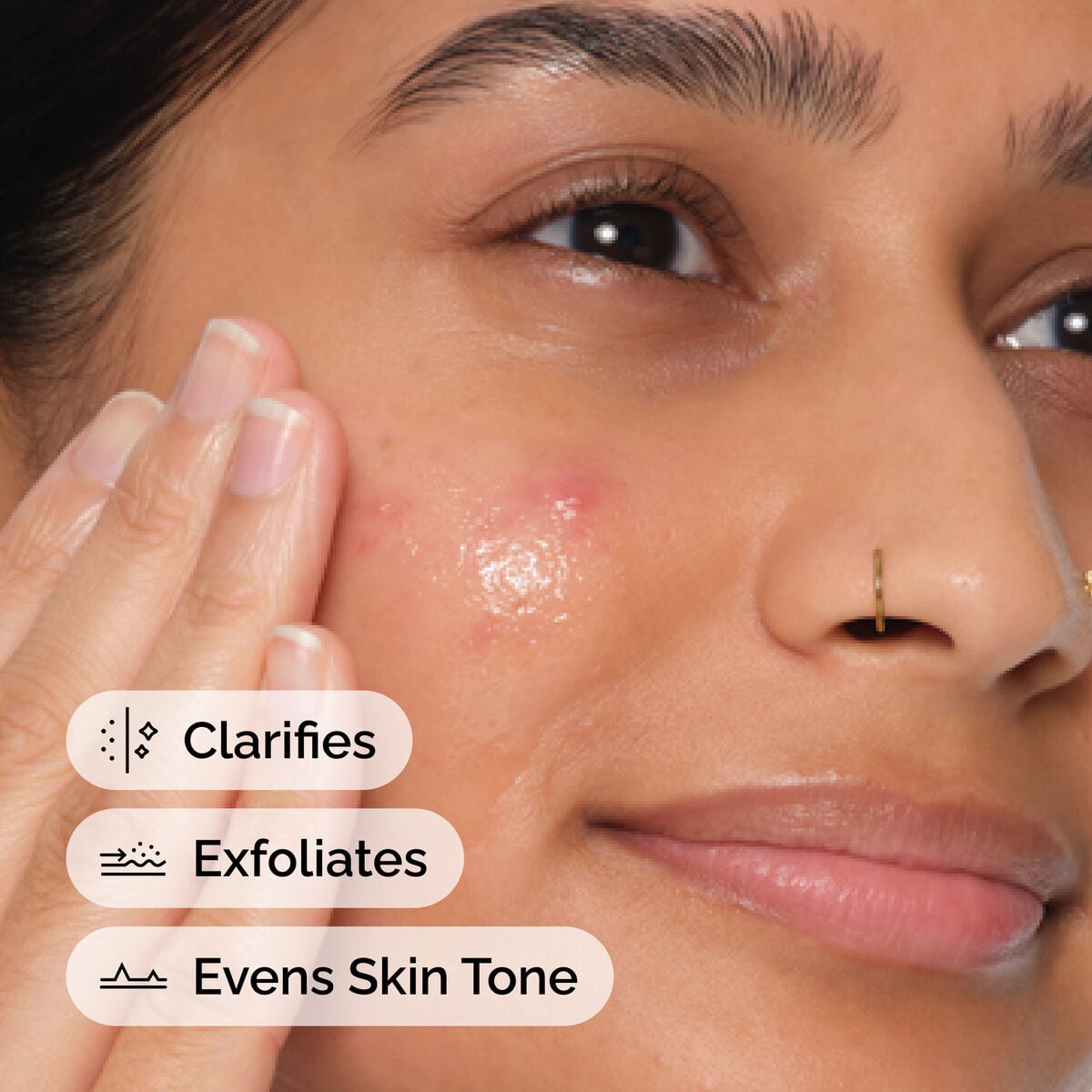 salicylic-acid-2-anhydrous-solution-y4 FY25-D41247-ORD-Web-PDP-SA-2pct-Anh-1x1-EN-4f.jpg