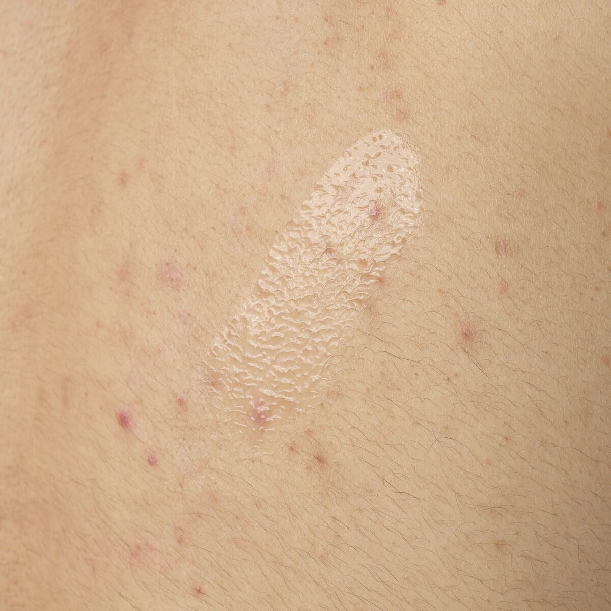 salicylic-acid-0-5-body-serum-i9 ORD-salicylic-acid-05-body-240ml-application.jpg