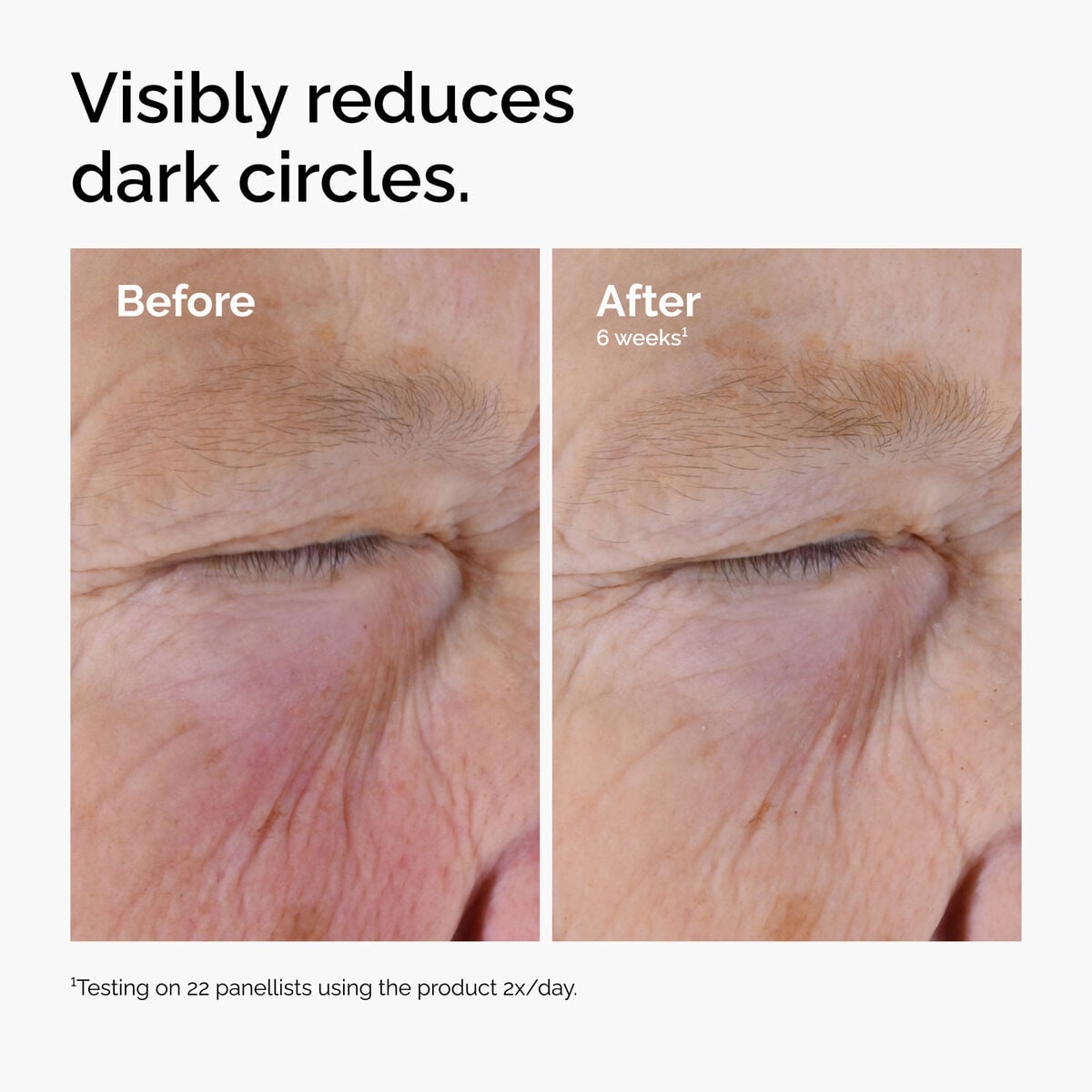 caffeine-solution-5-egcg-eye-serum-r7 ord-caffeine-solution-egcg-dark-circles-before-after.jpg