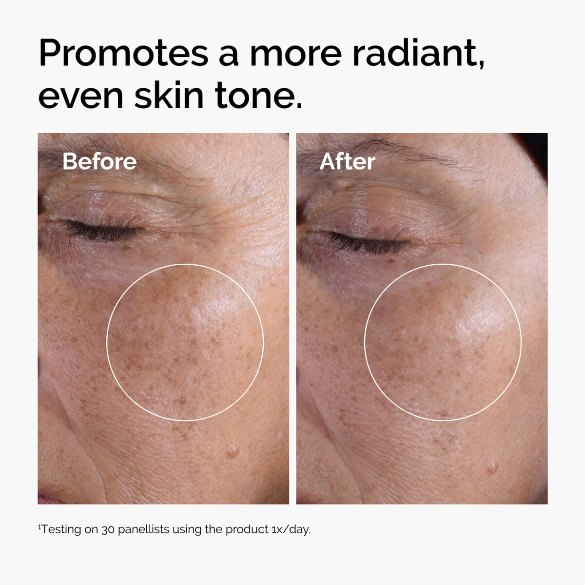 glycolic-acid-7-exfoliating-toner-j4 ord-glycolic-before-after-radiance.jpg