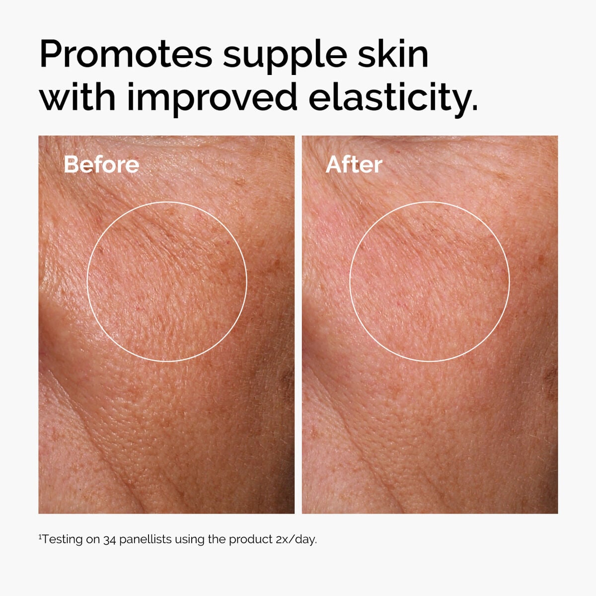 hyaluronic-acid-2-b5-with-ceramides-r8 ord-hyaluronic-acid-2pct-b5-hydrating-serum-before-after-elasticity.jpg