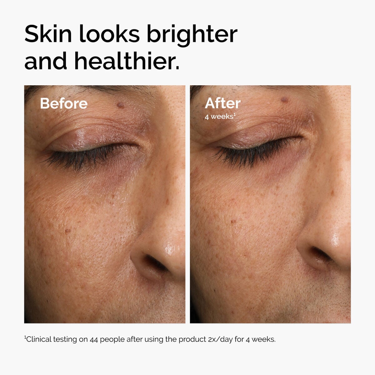 multi-antioxidant-radiance-serum-f3 ord-mars-before-after-healthy.jpg