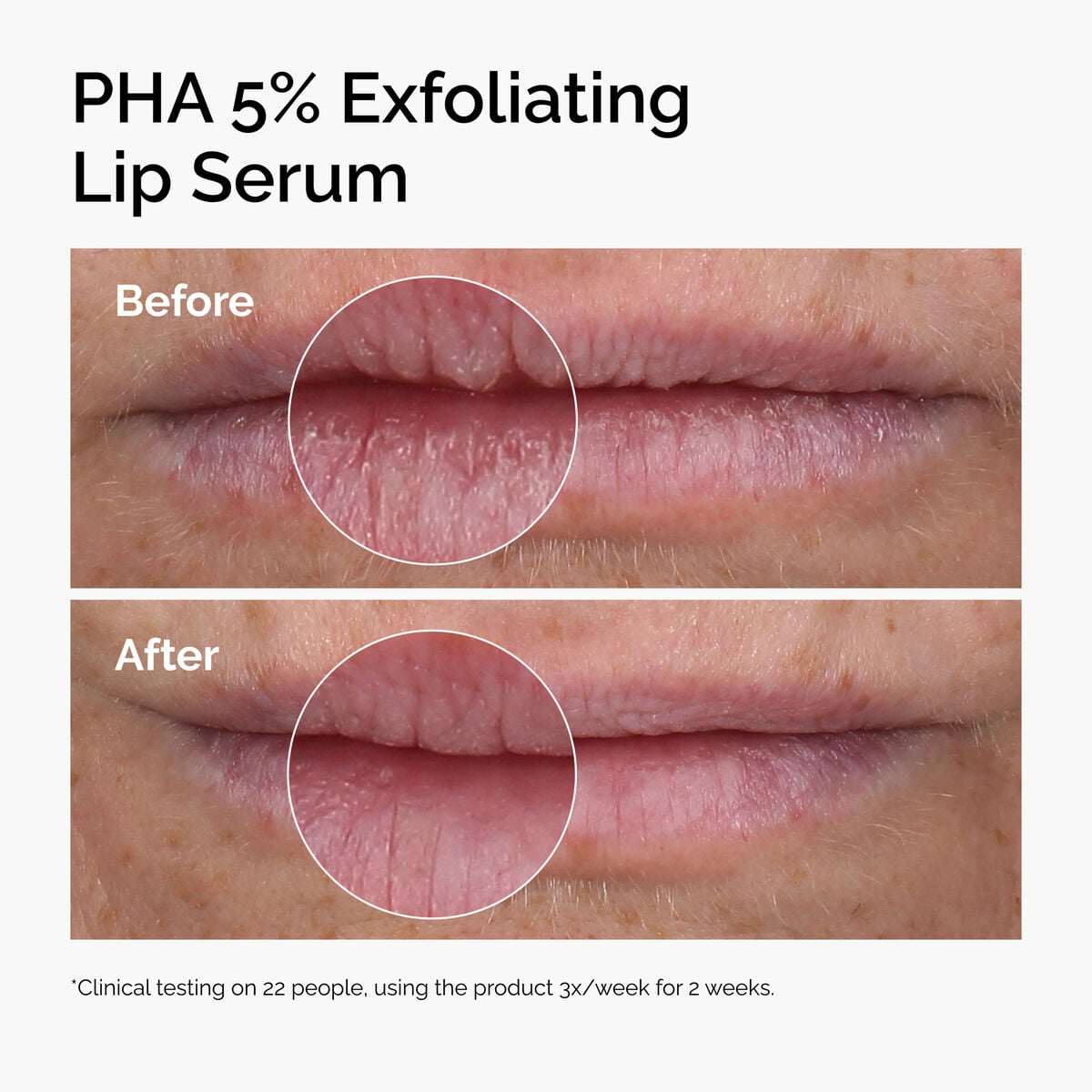 pha-5-exfoliating-lip-serum-s9 ord-pha-5pct-lip-exfoliating-serum-before-after.jpg