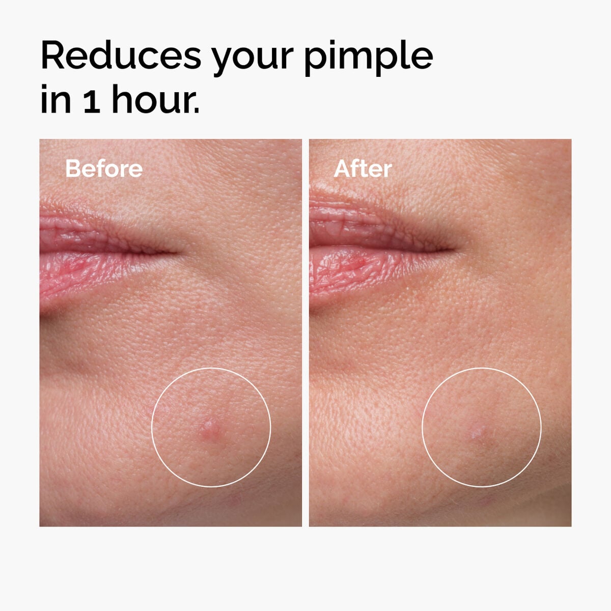 sulfur-10-powder-to-cream-concentrate-k0 ord-sulfur-10pct-powder-to-cream-concentrate-before-after-NA.jpg