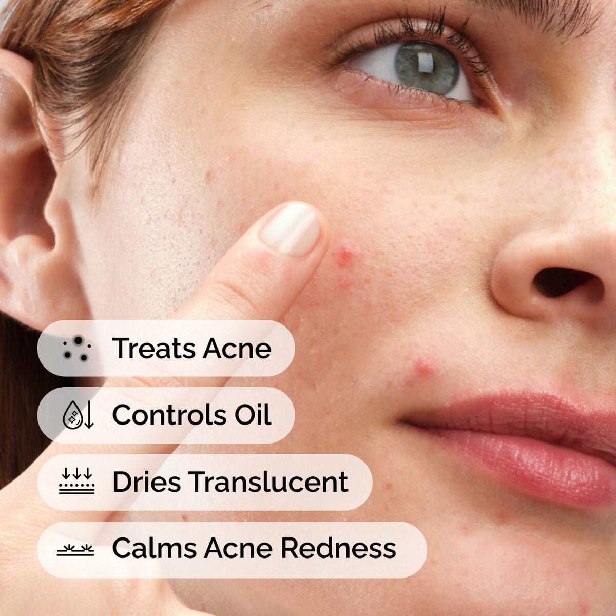 sulfur-10-powder-to-cream-concentrate-k0 ord-sulfur-10pct-powder-to-cream-concentrate-model-application-with-benefits-acne.jpg